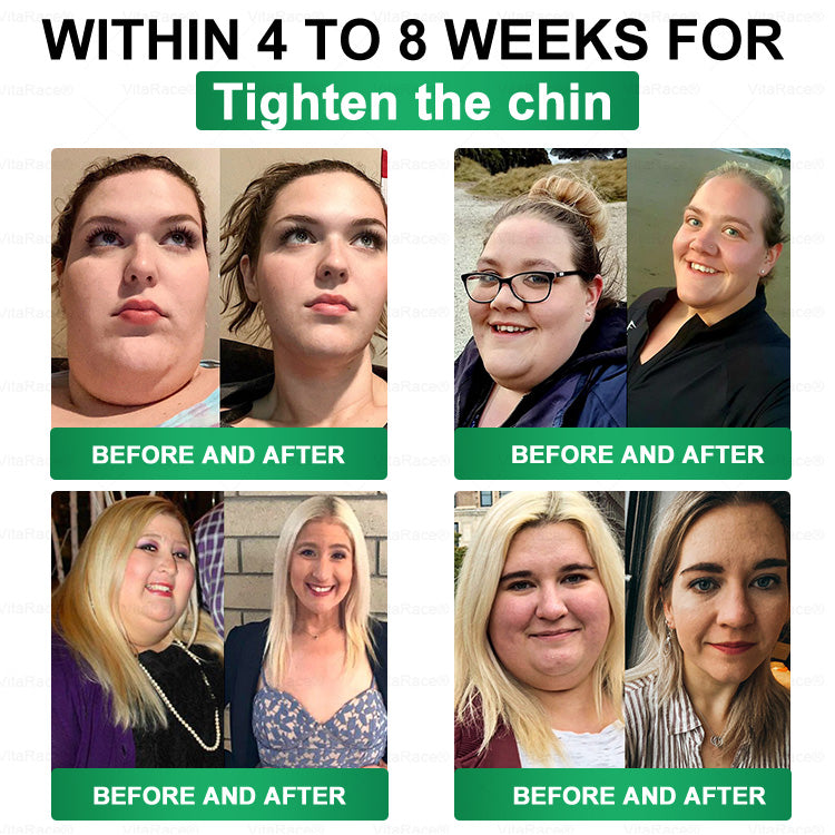 𝐕𝐢𝐭𝐚𝐑𝐚𝐜𝐞® 𝑴𝒆𝒕𝒂𝒃𝒐𝒍𝒊𝒄 𝑵𝒂𝒏𝒐 𝑴𝒊𝒄𝒓𝒐𝒏𝒆𝒆𝒅𝒍𝒆 𝑷𝒂𝒕𝒄𝒉🇺🇸(𝐉𝐮𝐬𝐭 𝐨𝐧𝐜𝐞 𝐚 𝐝𝐚𝐲, 𝐯𝐢𝐬𝐢𝐛𝐥𝐞 𝐜𝐡𝐚𝐧𝐠𝐞𝐬 𝐢𝐧 𝟕 𝐝𝐚𝐲𝐬）𝘽𝙚𝙧𝙗𝙚𝙧𝙞𝙣𝙚 + 𝙈𝙤𝙧𝙞𝙣𝙜𝙖 𝙁𝙤𝙧𝙢𝙪𝙡𝙖 ✅ 𝐅𝐨𝐫 𝐨𝐛𝐞𝐬𝐢𝐭𝐲, 𝗟𝗼𝗼𝘀𝗲 𝘀𝗸𝗶𝗻,𝐝𝐢𝐚𝐛𝐞𝐭𝐞𝐬, 𝐬𝐥𝐞𝐞𝐩 𝐚𝐩𝐧𝐞𝐚, 𝐣𝐨𝐢𝐧𝐭 𝐢𝐬𝐬𝐮𝐞𝐬, 𝐚𝐧𝐝 𝐦𝐨𝐫𝐞 ☘️